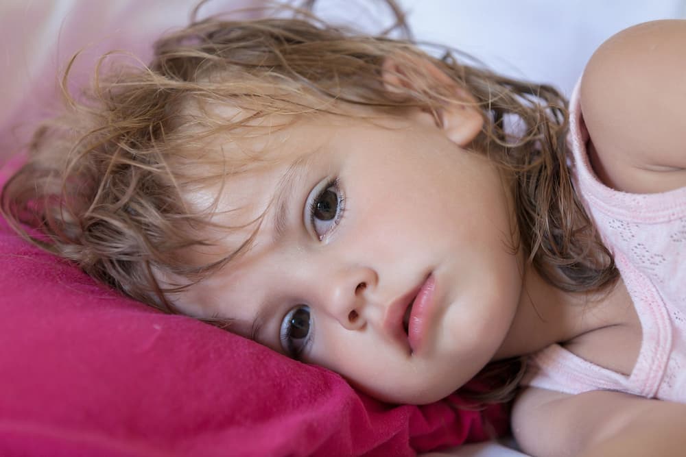Syndrom nieuczesanych włosów – na czym polega, kiedy występuje?