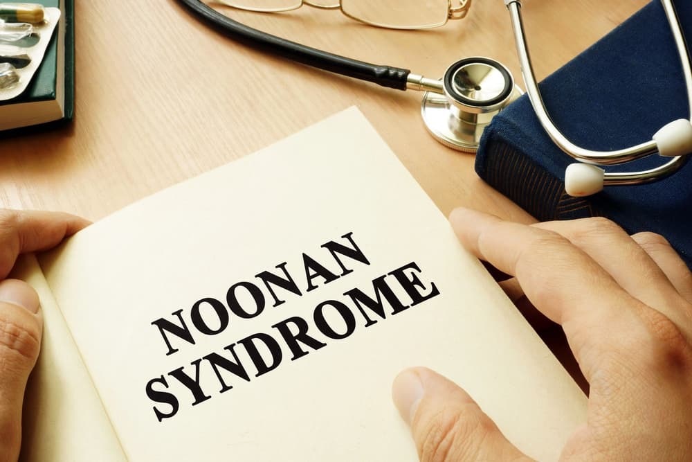 Zespół Noonan – przyczyny, objawy i leczenie