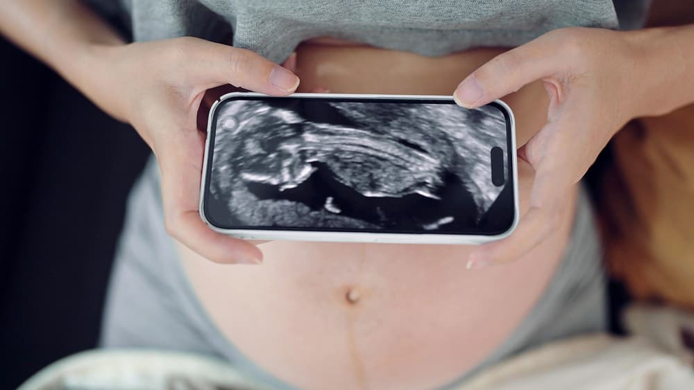 brzuch kobiety i zdjęcie USG dziecka w trzecim trymestrze ciąży