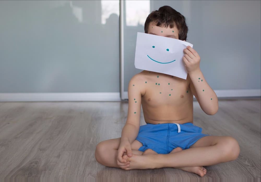 Plamica Schönleina–Henocha – przyczyny objawy, leczenie Plamica Schönleina–Henocha – przyczyny objawy, leczenie