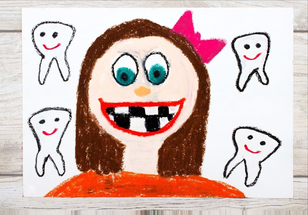 Próchnica zębów mlecznych – przyczyny, leczenie, zapobieganie próchnicy mleczaków Próchnica zębów mlecznych – przyczyny, leczenie, zapobieganie próchnicy mleczaków