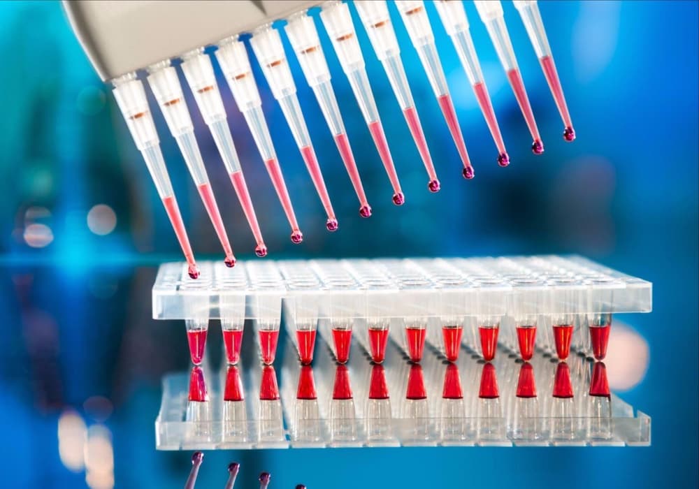 Ureaplasma w ciąży (Ureaplasma Urealyticum) – objawy, badania i leczenie ureaplasmy Ureaplasma w ciąży (Ureaplasma Urealyticum) – objawy, badania i leczenie ureaplasmy