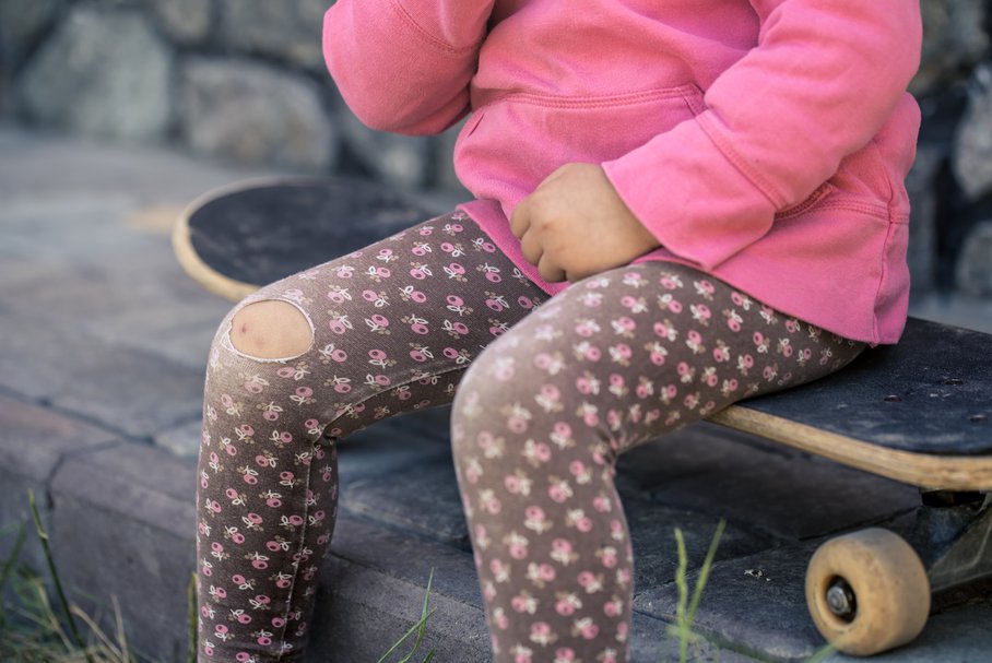 koślawość i szpotawość kolan u dzieci