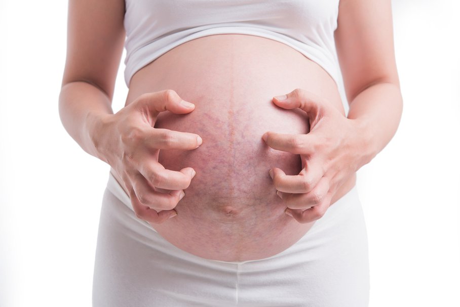problemy skórne w ciąży