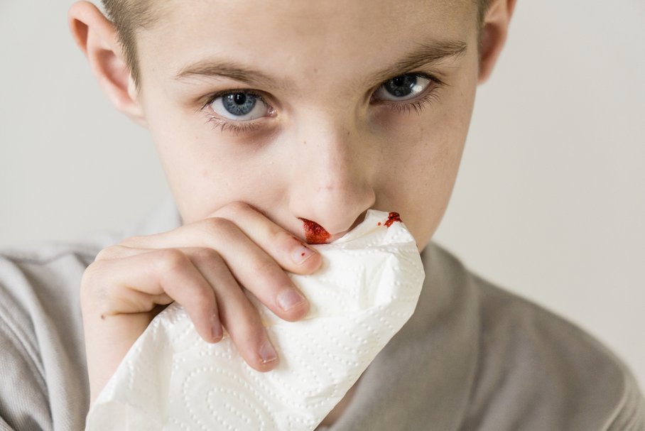 Chłopiec zatrzymujący krwawienie z nosa.