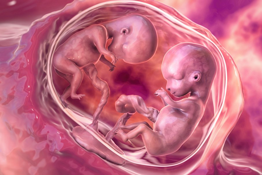 fetus in fetu